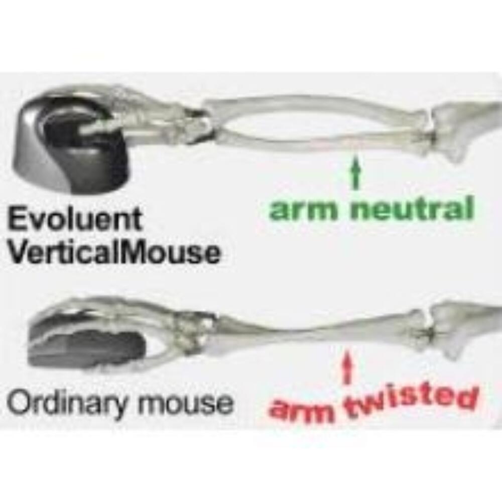 Evoluent 4 verticale muis linkshandig bedraad