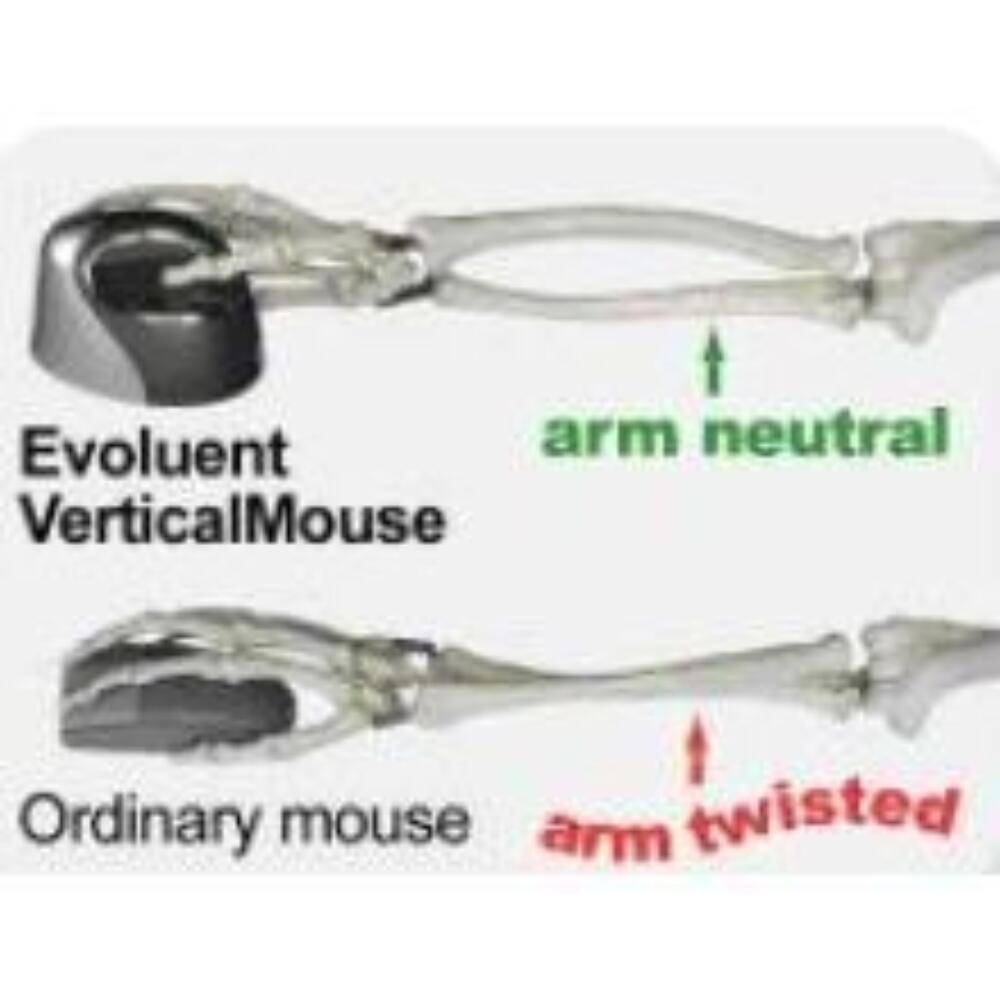 Evoluent 4 verticale muis small rechtshandig bedraad