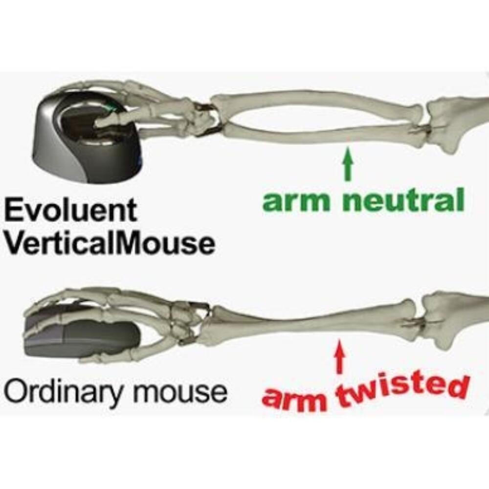 Evoluent C vertikale Maus rechtshändig verkabelt